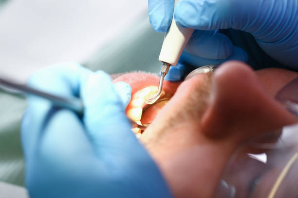 Best Emergency Dental Care for Sports Injuries in Six Mile, SC