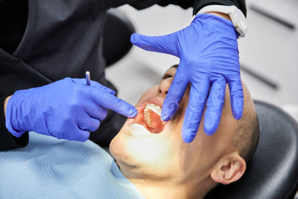 Best Urgent Dental Care for Toothaches in Six Mile, SC